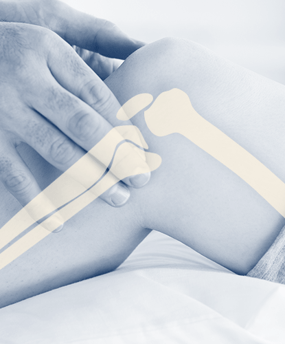 Segmento ortopedia - foto de joelho com desenho de ossos